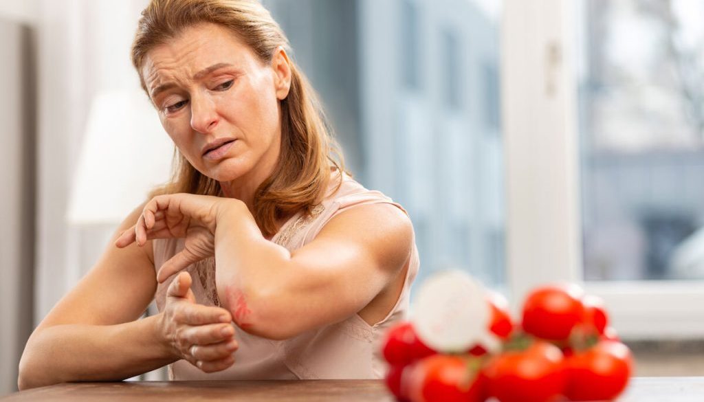 sensibilite histamine